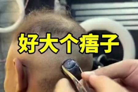 头发里的神秘符号：揭秘头部痣相的神秘力量