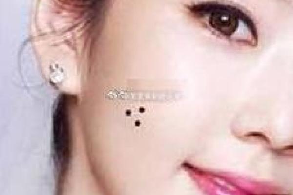 一痣定终身？揭秘女人耳痣的神秘力量