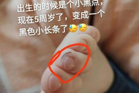 脚底痣相运势揭秘：你的痣相暗示了怎样的命运？