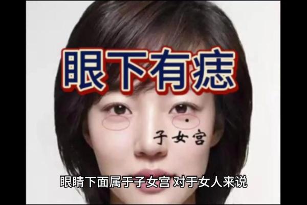 眼底藏宝：揭秘眼睛内痣的独特魅力