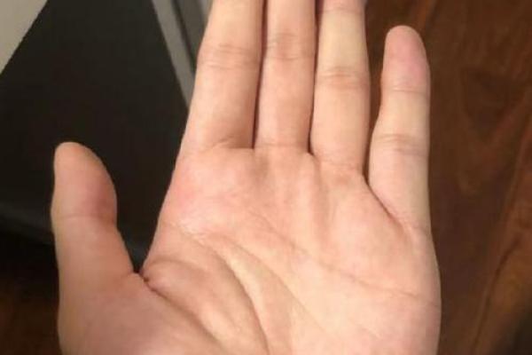 手相揭秘：掌握健康线，一眼看穿你的身体状况