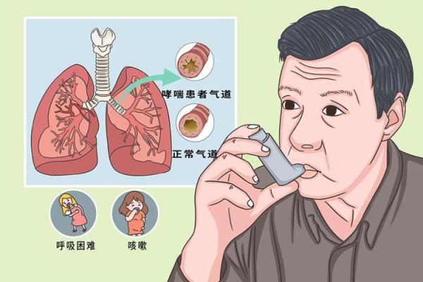 哮喘节：传统习俗与呼吸健康的完美融合