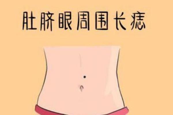 脐中藏宝：揭秘相女脐痣的秘密