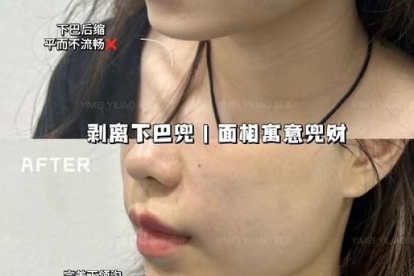 尖下巴女人运势揭秘：揭秘面相中的财富与魅力密码