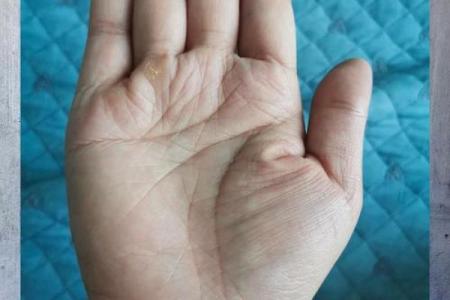 手相揭秘：掌握健康线，一眼看穿你的身体状况