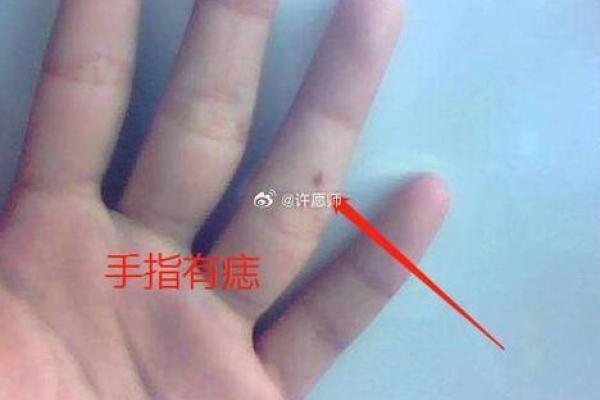 锁骨下的神秘印记：痣相背后的故事