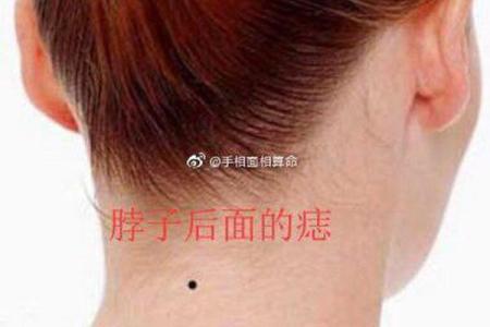 命运之谜：不婚痣相背后的惊人真相