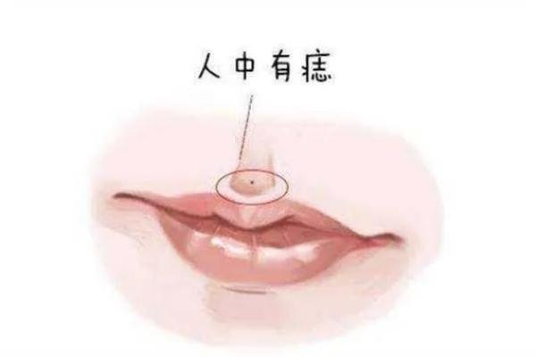 痣相解析：嘴角上痣竟预示着贫穷？