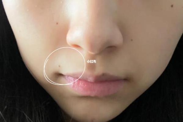 嘴角笑痣：桃花运势大旺？