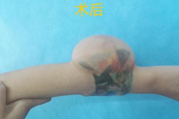 奇迹枕骨痣，带你探索未知命运