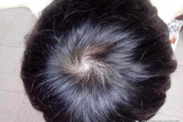 右旋发丝蕴藏的财运密码：揭秘头发右旋面相的惊人魅力