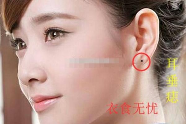 独特耳痣，女孩的魅力加分项