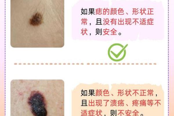 神秘痣相：两个毛的神奇魅力揭秘
