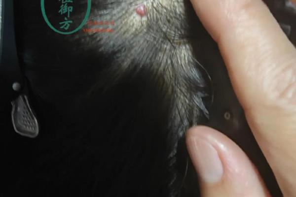 肉瘊面相揭秘：面相大师教你如何识别运势旺衰