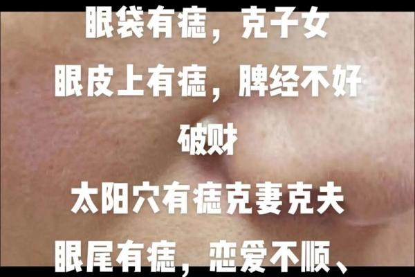 鼻上藏珠，财运亨通，痣相解析来袭