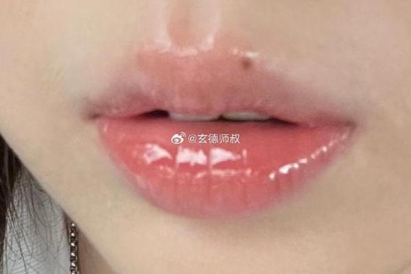 嘴唇痣相大揭秘：揭秘你的命运密码