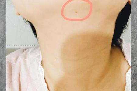 下巴有痣，财运滚滚来？揭秘女人富贵痣的神奇力量