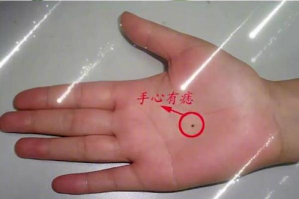 痣相解读：揭秘手相中的运势密码