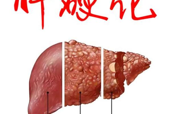 乙肝：揭秘富贵命背后的真相