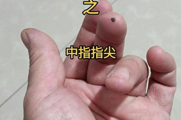 手上痣相解密：一指之间，命运早已注定