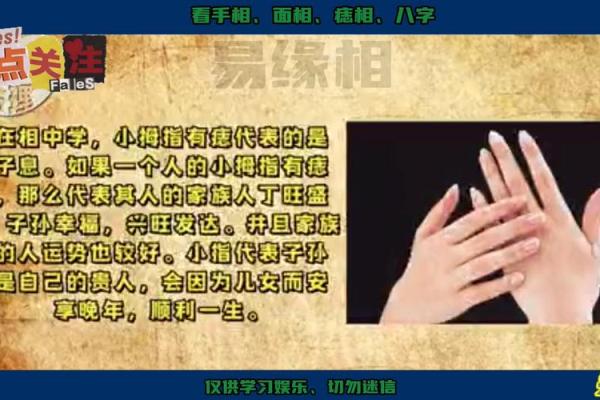 手上痣相解密：一指之间，命运早已注定