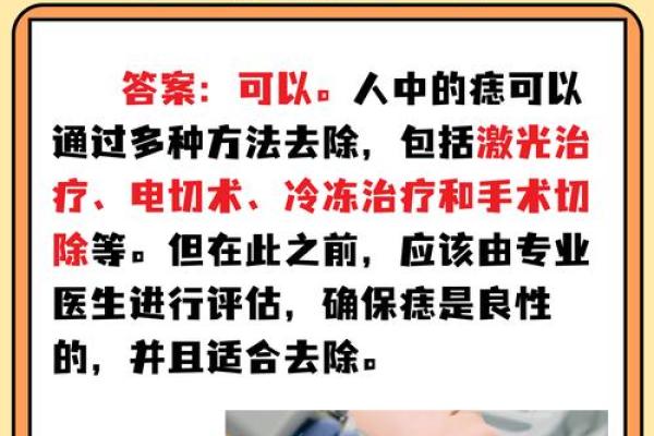 祛痣禁忌大揭秘：真的会影响命运吗？