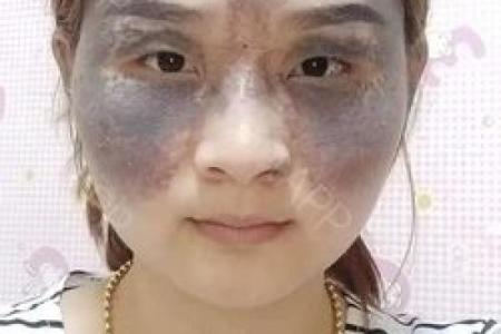 痣相与健康：科学家带你探索胎记背后的科学故事