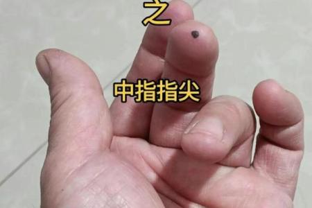 手上痣相解密：一指之间，命运早已注定