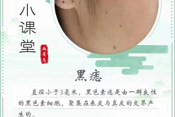 痣相学真的存在？一探究竟