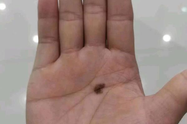 痣相解读：掌握兵权者的独特印记