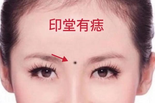 印堂痣相揭秘：运势旺衰全在这一点