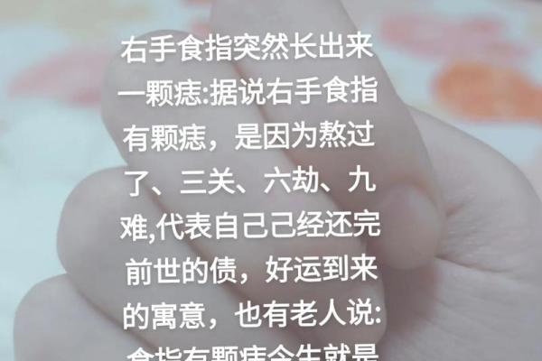 痣相运势：一痣在手，运势我有