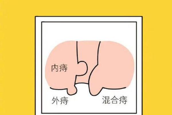 男肛门痣相，揭秘命运之谜