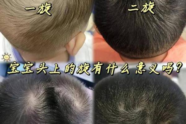 头顶旋代表什么？命理专家深度分析