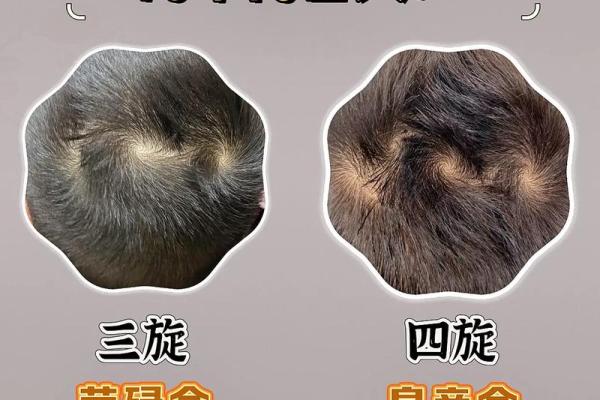头顶旋代表什么？命理专家深度分析