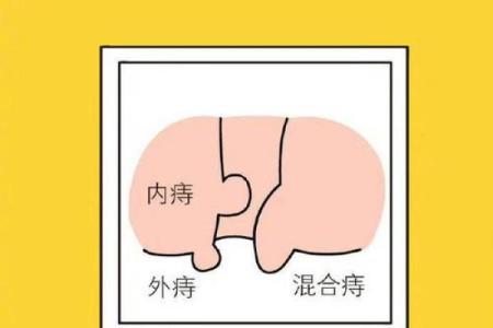 男肛门痣相，揭秘命运之谜