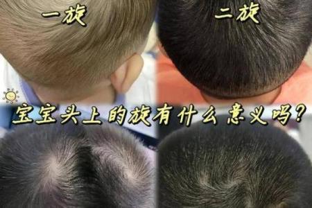 头顶旋代表什么？命理专家深度分析