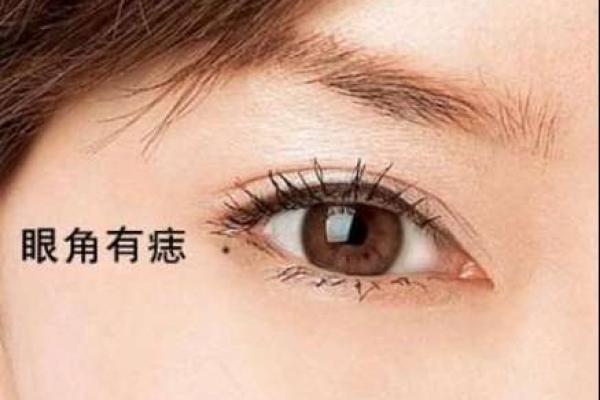 痣相揭秘：精准解读命运走向的神秘符号