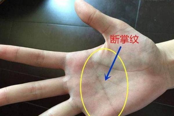 揭秘断掌手相：太阳线预示的惊人命运