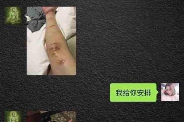 左臂痣相：她的人生轨迹，从此被彻底改变