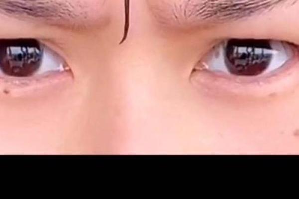 女人印堂八字纹的面相解析，命运暗示你是否幸福