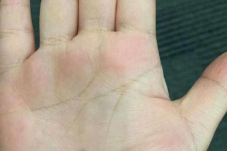手相揭秘：手中有痣竟预示财运亨通，财运亨通的秘密