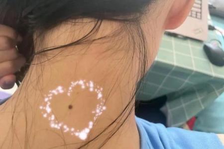腹有秘密，痣相惊人