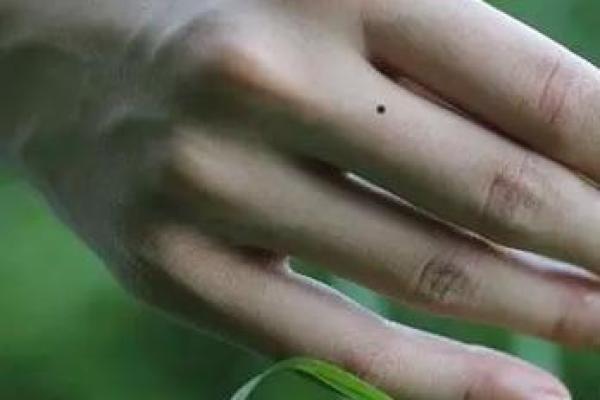 女土痣食相：揭秘古代神秘传说，你敢信吗？