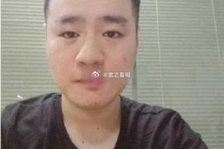山根有痣：财运滚滚，事业有成
