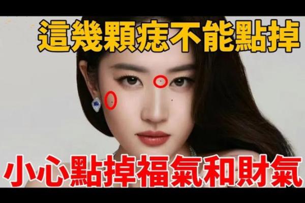 大富痣：传说中的富贵命相，你了解多少？