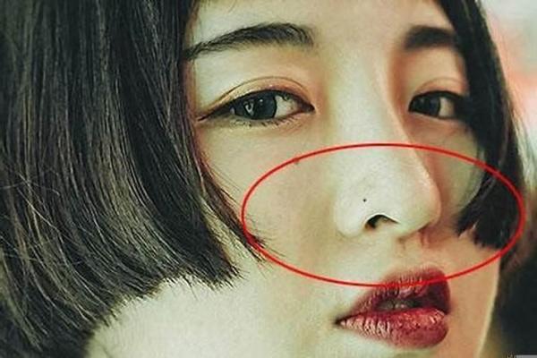 鼻翼下有痣，注定不平凡的人生