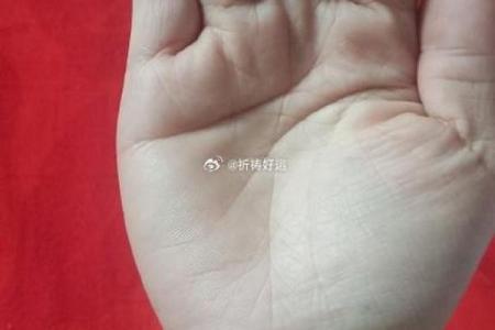 天赐吉祥痣，手心平痣显尊贵