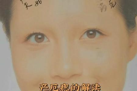 天生克星，揭秘厄运痣相的秘密