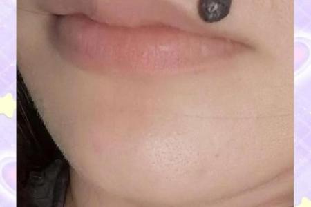 女人嘴上痣的秘密：预示着怎样的命运？